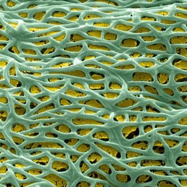 08 Abrochia.jpg